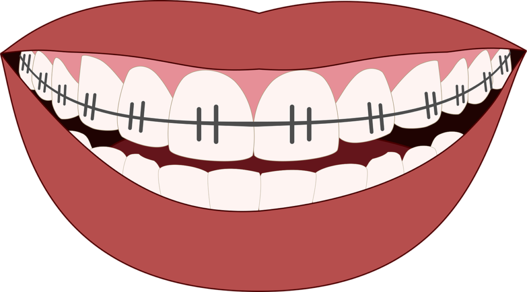 Mund mit Zahnspange